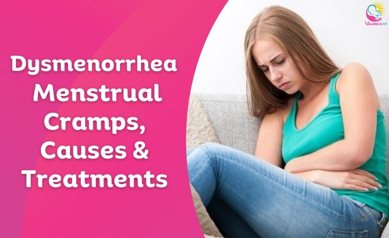 Dysmenorrhea: Menstrual Cramps, Causes, and Treatments