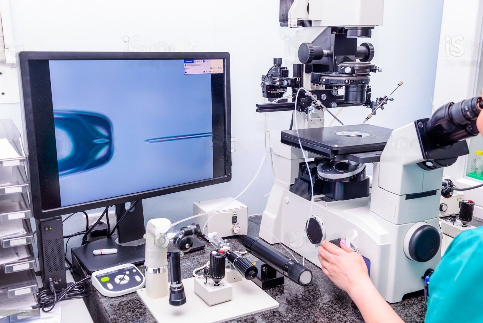 ICSI Treatment in Lucknow