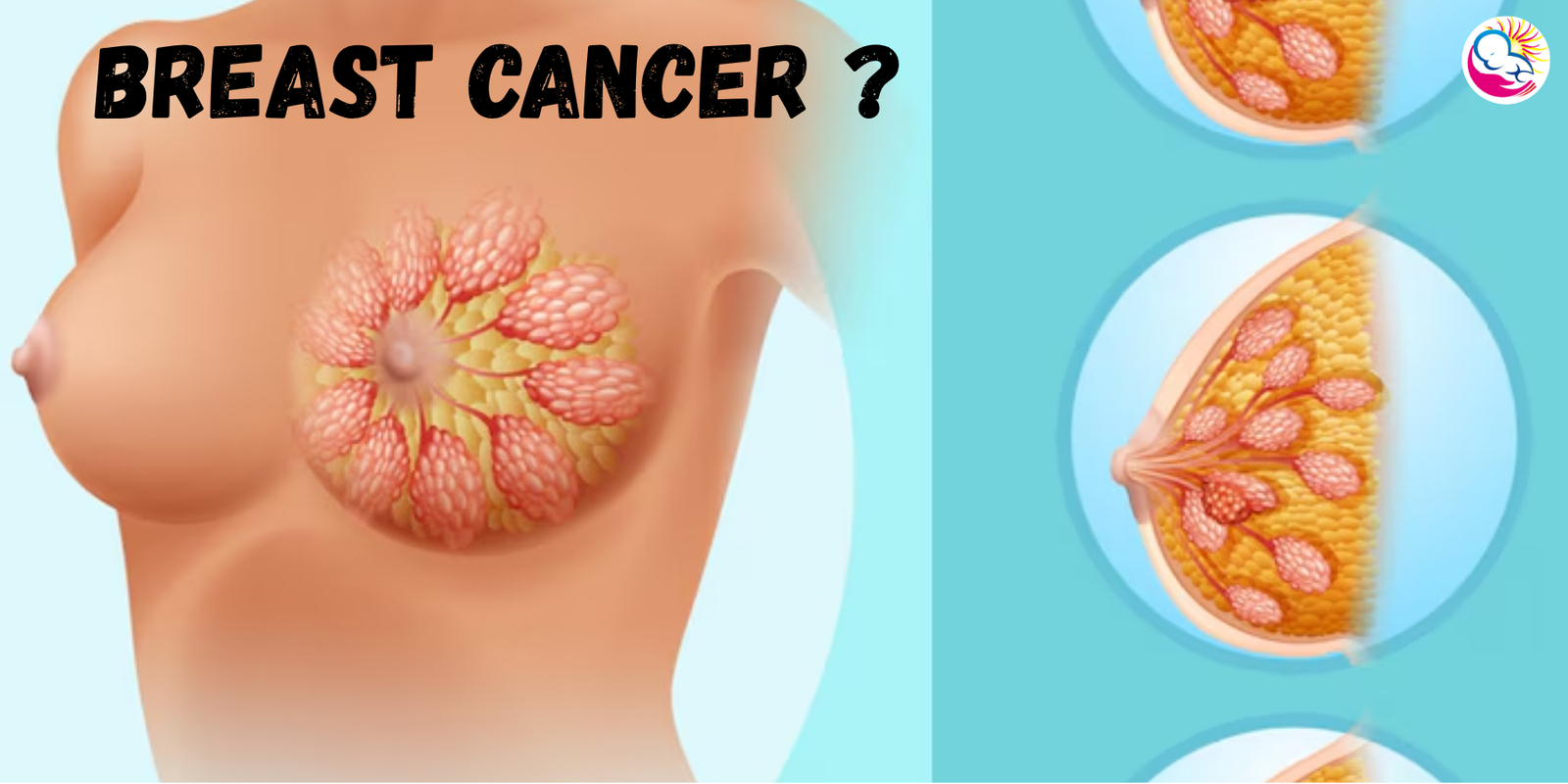 Understanding Breast Cancer: Early Detection, Treatment & Fertility Considerations